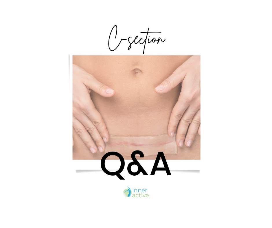 Recovery After C-Section – Advice from a Women's Health Physiotherapist -  Inner Active Physio